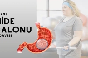 Mide Balonu Nedir