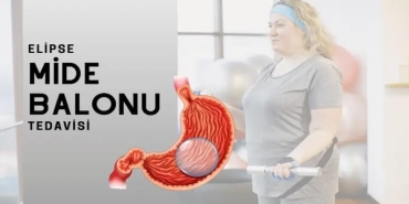 Mide Balonu Nedir