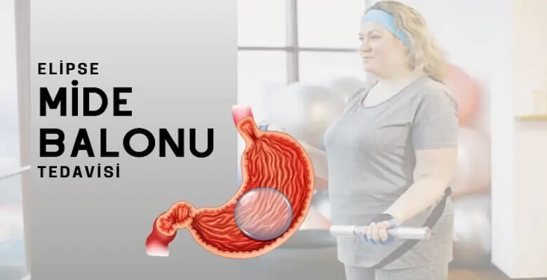 Mide Balonu Nedir